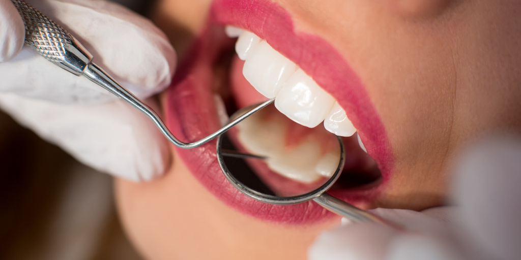 What are the advantages of cosmetic dentistry abroad_ (1).png
