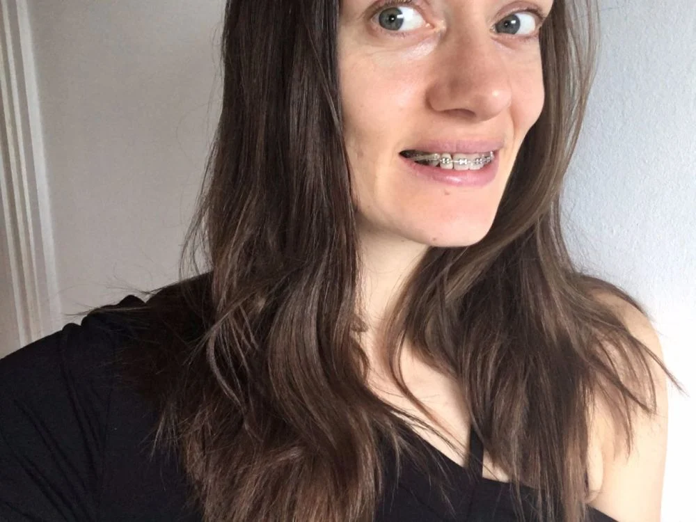 adult braces at 30 selfie with top train track braces and elastics showing